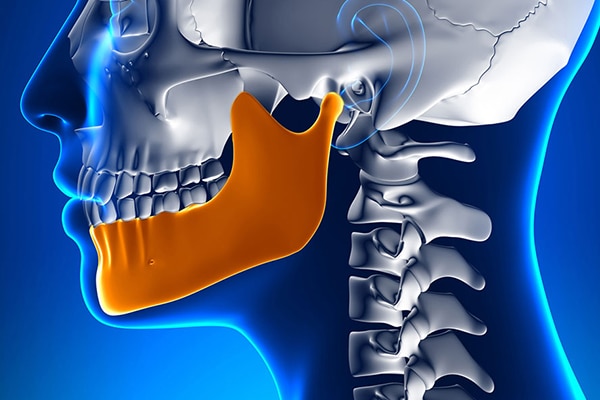 Orthognathic Surgery